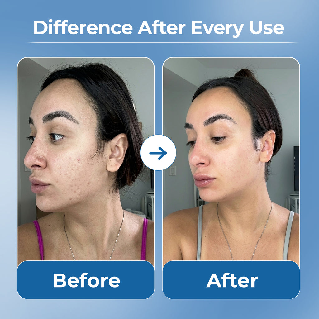 4-in-1 Electric Facial Cleansing Brush