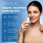 Rechargeable Blackhead Remover Vacuum